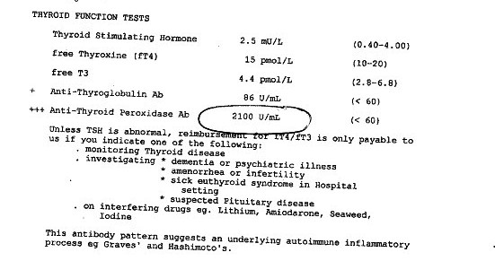 Thyroid Laboratory Test Results Chart