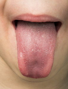 Human Tongue Protruding Out